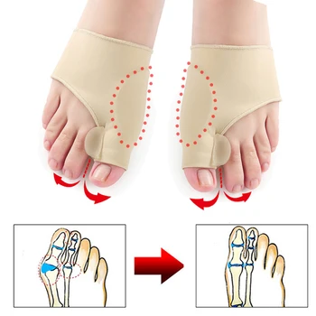 Ayak başparmağı Düzeltici ortopedik çoraplar Ağrı kesici Ayak Bakımı Düzeltme Aracı Ayak Koruyucu Silikon Pedikür Çorap